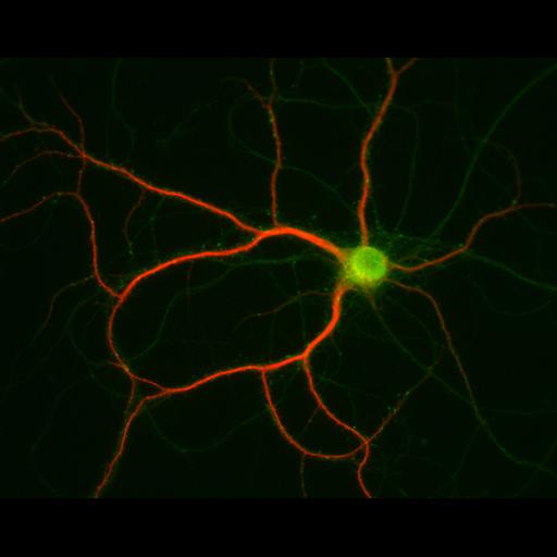  NCBI Organism:Rattus; Cell Types:multipolar neuron Cell Components:dendrite, microtubule cytoskeleton, synapse part; Biological process:cellular developmental process, dendrite development, establishment or maintenance of cell polarity, synapse assembly, protein localization to synapse;