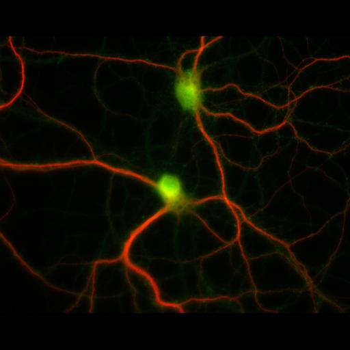  NCBI Organism:Rattus; Cell Types:multipolar neuron Cell Components:dendrite, microtubule cytoskeleton, synapse part; Biological process:cellular developmental process, dendrite development, establishment or maintenance of cell polarity, synapse assembly, protein localization to synapse;