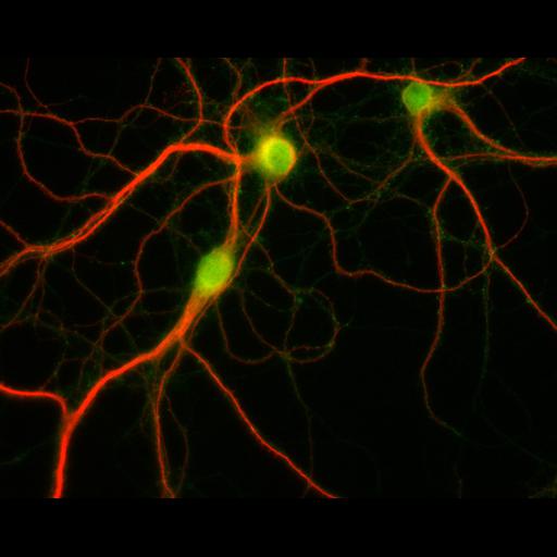  NCBI Organism:Rattus; Cell Types:multipolar neuron Cell Components:dendrite, microtubule cytoskeleton, synapse part; Biological process:cellular developmental process, dendrite development, establishment or maintenance of cell polarity, synapse assembly, protein localization to synapse;