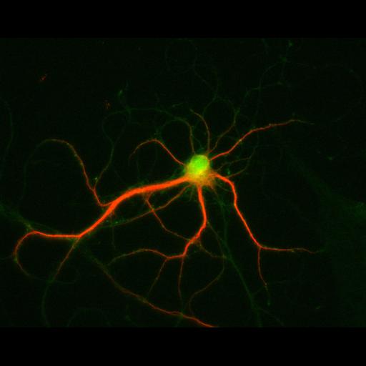  NCBI Organism:Rattus; Cell Types:multipolar neuron Cell Components:dendrite, microtubule cytoskeleton, synapse part; Biological process:cellular developmental process, dendrite development, establishment or maintenance of cell polarity, synapse assembly, protein localization to synapse;