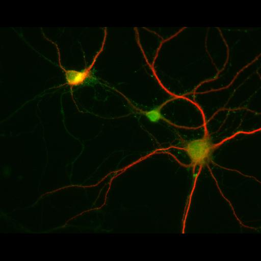  NCBI Organism:Rattus; Cell Types:multipolar neuron Cell Components:dendrite, microtubule cytoskeleton, synapse part; Biological process:cellular developmental process, dendrite development, establishment or maintenance of cell polarity, synapse assembly, protein localization to synapse;