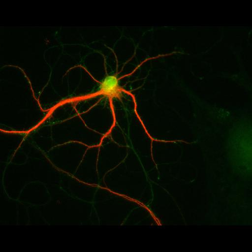  NCBI Organism:Rattus; Cell Types:multipolar neuron Cell Components:dendrite, microtubule cytoskeleton, synapse part; Biological process:cellular developmental process, dendrite development, establishment or maintenance of cell polarity, synapse assembly, protein localization to synapse;