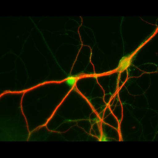  NCBI Organism:Rattus; Cell Types:multipolar neuron Cell Components:dendrite, microtubule cytoskeleton, synapse part; Biological process:cellular developmental process, dendrite development, establishment or maintenance of cell polarity, synapse assembly, protein localization to synapse;