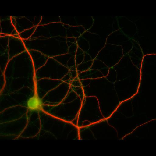  NCBI Organism:Rattus; Cell Types:multipolar neuron Cell Components:dendrite, microtubule cytoskeleton, synapse part; Biological process:cellular developmental process, dendrite development, establishment or maintenance of cell polarity, synapse assembly, protein localization to synapse;