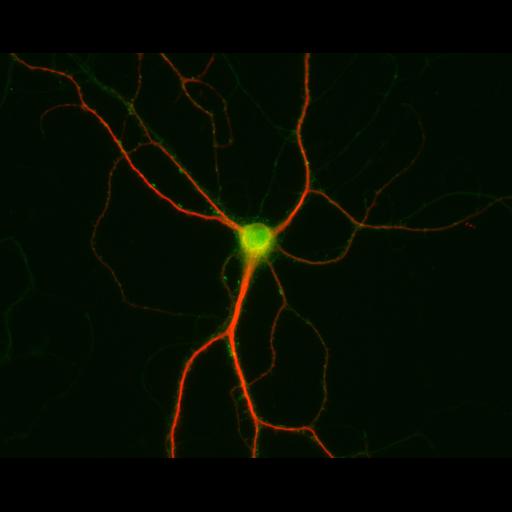  NCBI Organism:Rattus; Cell Types:multipolar neuron Cell Components:dendrite, microtubule cytoskeleton, synapse part; Biological process:cellular developmental process, dendrite development, establishment or maintenance of cell polarity, synapse assembly, protein localization to synapse;