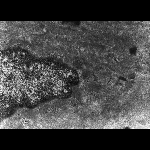  NCBI Organism:Rana catesbeiana; Cell Types:barrier epithelial cell Cell Components:intermediate filament cytoskeleton, plasma membrane; Biological process:intermediate filament cytoskeleton organization