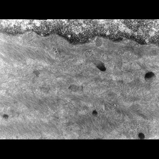  NCBI Organism:Rana catesbeiana; Cell Types:barrier epithelial cell Cell Components:intermediate filament cytoskeleton, plasma membrane; Biological process:intermediate filament cytoskeleton organization