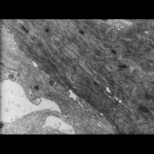  NCBI Organism:Rana catesbeiana; Cell Types:barrier epithelial cell Cell Components:intermediate filament cytoskeleton, plasma membrane; Biological process:intermediate filament cytoskeleton organization