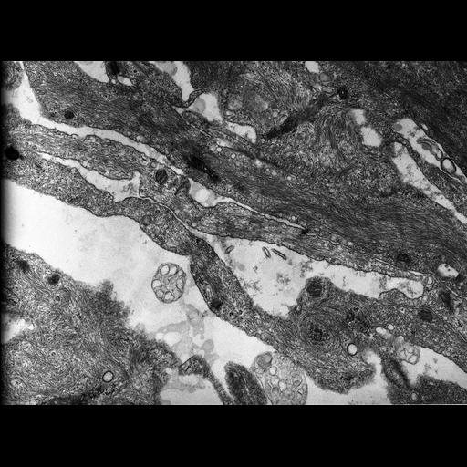  NCBI Organism:Rana catesbeiana; Cell Types:barrier epithelial cell Cell Components:intermediate filament cytoskeleton, plasma membrane; Biological process:intermediate filament cytoskeleton organization