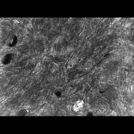  NCBI Organism:Rana catesbeiana; Cell Types:barrier epithelial cell Cell Components:intermediate filament cytoskeleton, plasma membrane; Biological process:intermediate filament cytoskeleton organization