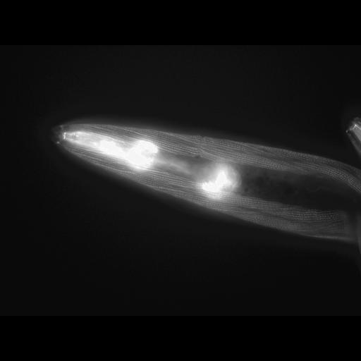  NCBI Organism:Caenorhabditis elegans; Cell Types:muscle cell Cell Components:actin filament Biological process:chronological cell aging