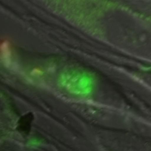  NCBI Organism:Toxoplasma gondii RH; Cell Components:cortical microtubule Biological process:regulation of cell shape