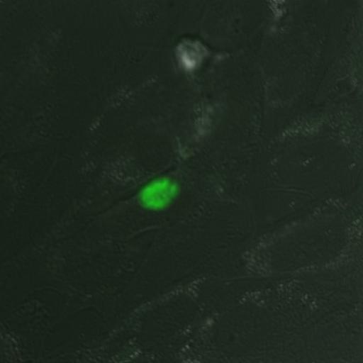  NCBI Organism:Toxoplasma gondii RH; Cell Components:cortical microtubule Biological process:regulation of cell shape, microtubule cytoskeleton organization;