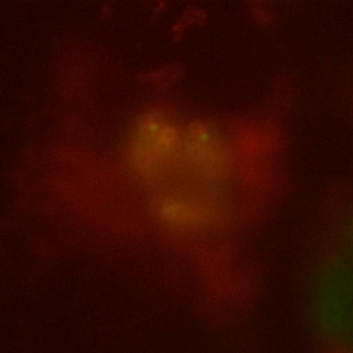  NCBI Organism:Toxoplasma gondii RH; Cell Components:dynein complex, centriole, polar ring of apical complex, spindle pole, conoid; Biological process:regulation of cell shape, microtubule-based movement;