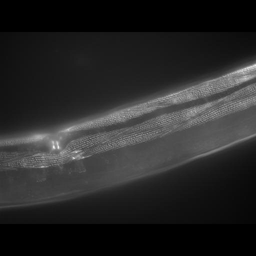  NCBI Organism:Caenorhabditis elegans; Cell Types:muscle cell Cell Components:actin filament Biological process:chronological cell aging