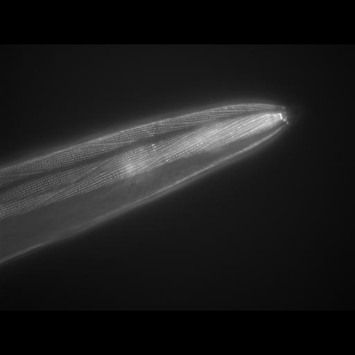  NCBI Organism:Caenorhabditis elegans; Cell Types:muscle cell Cell Components:actin filament Biological process:chronological cell aging