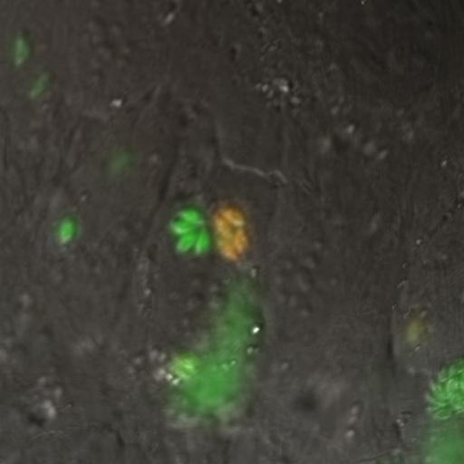  NCBI Organism:Toxoplasma gondii RH; Cell Components:cortical microtubule, spindle pole, centriole, conoid, inner membrane complex; Biological process:regulation of cell shape, microtubule cytoskeleton organization, cell division;