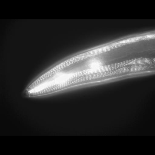  NCBI Organism:Caenorhabditis elegans; Cell Types:muscle cell Cell Components:actin filament Biological process:chronological cell aging