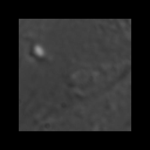  NCBI Organism:Toxoplasma gondii RH; Cell Components:dynein complex, centriole, spindle pole, conoid, cortical microtubule; Biological process:regulation of cell shape, microtubule-based movement, microtubule cytoskeleton organization;