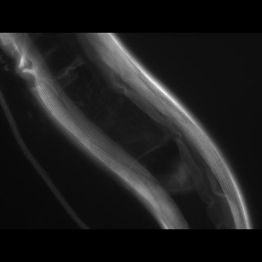  NCBI Organism:Caenorhabditis elegans; Cell Types:muscle cell Cell Components:actin filament Biological process:chronological cell aging