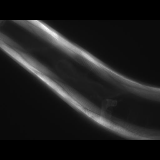  NCBI Organism:Caenorhabditis elegans; Cell Types:muscle cell Cell Components:actin filament Biological process:chronological cell aging