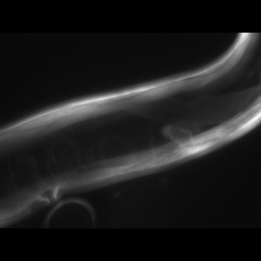  NCBI Organism:Caenorhabditis elegans; Cell Types:muscle cell Cell Components:actin filament Biological process:chronological cell aging