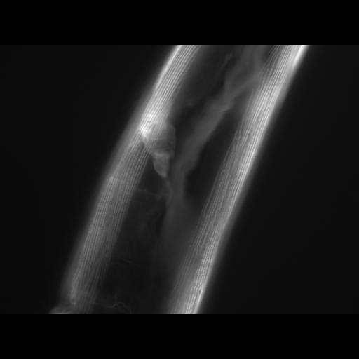  NCBI Organism:Caenorhabditis elegans; Cell Types:muscle cell Cell Components:actin filament Biological process:chronological cell aging
