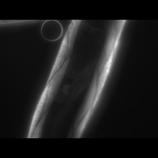  NCBI Organism:Caenorhabditis elegans; Cell Types:muscle cell Cell Components:actin filament Biological process:chronological cell aging