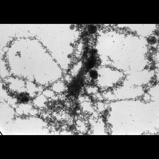  NCBI Organism:Notophthalmus viridescens; Cell Types:oocyte Biological process:, RNA metabolic process;