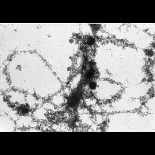  NCBI Organism:Notophthalmus viridescens; Cell Types:oocyte Biological process:, RNA metabolic process;