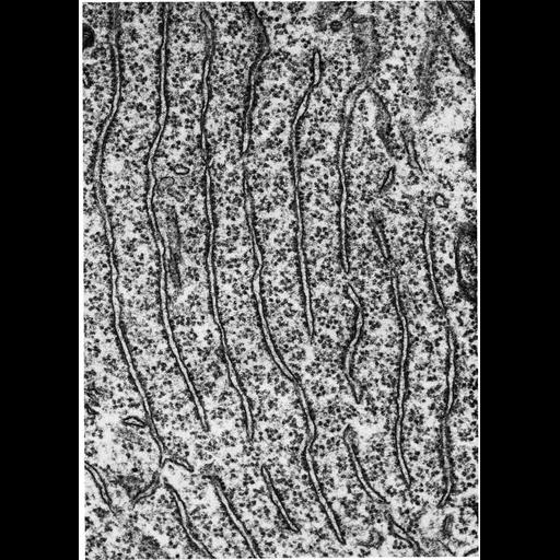  Cell Types:motor neuron Cell Components:endoplasmic reticulum, ribosome, rough endoplasmic reticulum; Biological process:translation