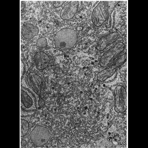  NCBI Organism:Rattus; Cell Types:hepatocyte Cell Components:endoplasmic reticulum, smooth endoplasmic reticulum; Biological process:triglyceride metabolic process