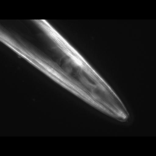  NCBI Organism:Caenorhabditis elegans; Cell Types:muscle cell Cell Components:actin filament Biological process:chronological cell aging