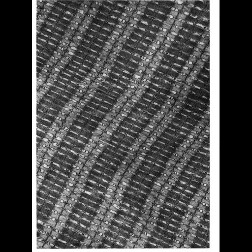  NCBI Organism:Opsanus tau; Cell Types:muscle cell Cell Components:sarcoplasmic reticulum, myofibril, I band, A band, Z disc, terminal cisterna; Biological process:muscle contraction