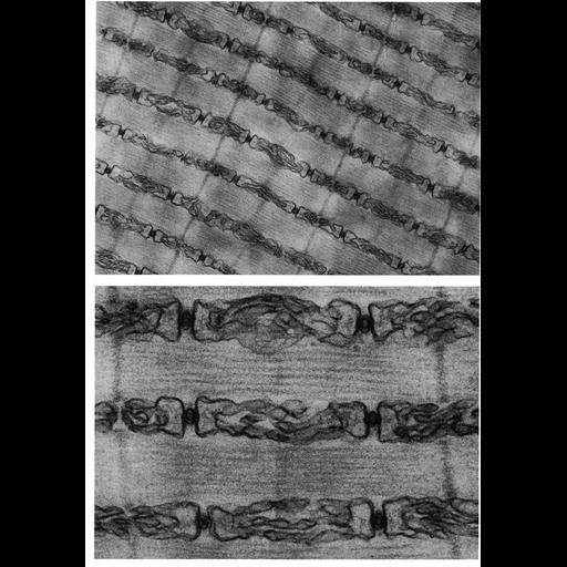  NCBI Organism:Opsanus tau; Cell Types:muscle cell Cell Components:sarcoplasmic reticulum, myofibril, I band, A band, Z disc, terminal cisterna; Biological process:muscle contraction