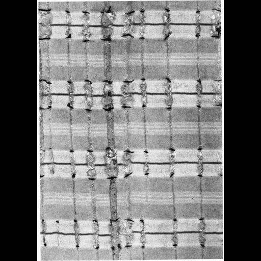  NCBI Organism:Mus musculus; Cell Types:skeletal muscle cell Cell Components:sarcoplasmic reticulum, myofibril, I band, A band, Z disc, terminal cisterna, sarcomere; Biological process:striated muscle contraction