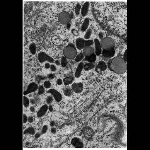  NCBI Organism:Perameles nasuta; Cell Types:epithelial cell Cell Components:lysosome, primary lysosome; Biological process:autophagy