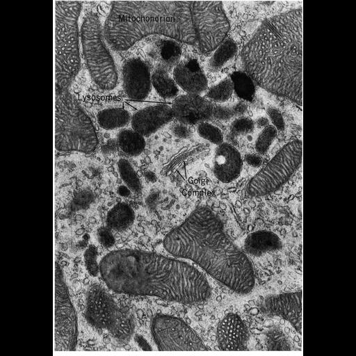  NCBI Organism:Phodopus; Cell Components:lysosome, Golgi apparatus, mitochondrion; Biological process:autophagy