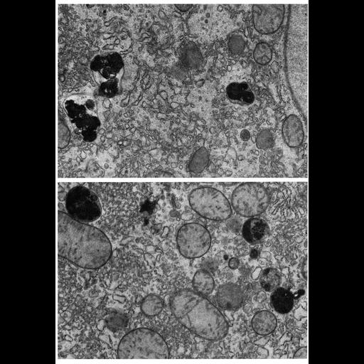  NCBI Organism:Phodopus; Cell Types:hepatocyte Cell Components:lysosome, primary lysosome, secondary lysosome; Biological process:autophagy