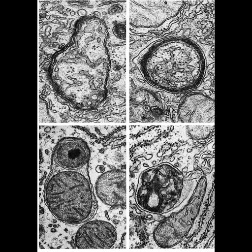  NCBI Organism:Rattus; Cell Types:hepatocyte Cell Components:autophagic vacuole, autophagic vacuole membrane, endoplasmic reticulum, ribosome, mitochondrion, peroxisome; Biological process:autophagy