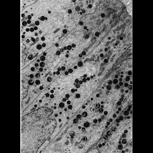  NCBI Organism:Leporidae; Cell Types:columnar/cuboidal epithelial cell Cell Components:lysosome, multivesicular body, apical part of cell; Biological process:autophagy, endosome to lysosome transport via multivesicular body sorting pathway;