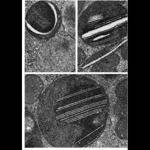  NCBI Organism:Sus scrofa; Cell Types:Leydig cell Cell Components:lysosome Biological process:autophagy