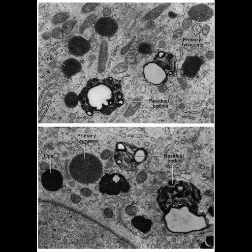  NCBI Organism:Chinchilla; Cell Types:Sertoli cell Cell Components:lysosome, primary lysosome, lytic vacuole, basal part of cell; Biological process:phagocytosis, autophagy;