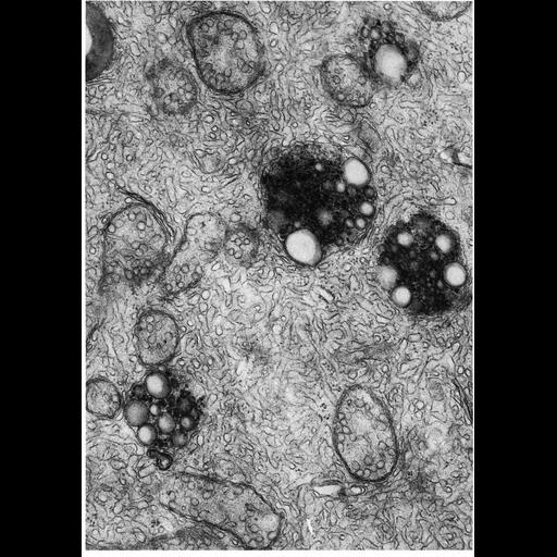  NCBI Organism:Homo sapiens; Cell Types:epithelial cell Cell Components:multivesicular body, lysosome; Biological process:endocytosis