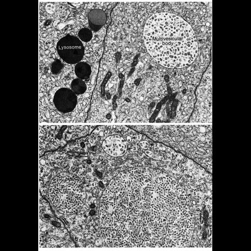  NCBI Organism:Homo sapiens; Cell Types:epithelial cell Cell Components:multivesicular body, lysosome; Biological process:regulation of multivesicular body size, endocytosis;