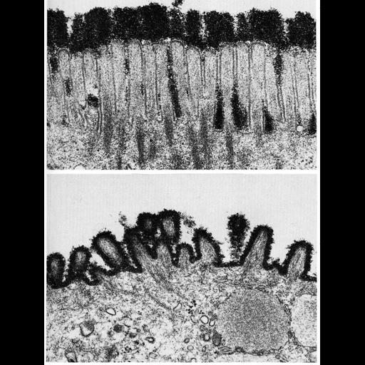  Cell Types:epithelial cell, enterocyte; Cell Components:plasma membrane, extracellular region part, glycocalyx, microvillus; Biological process:extracellular structure organization