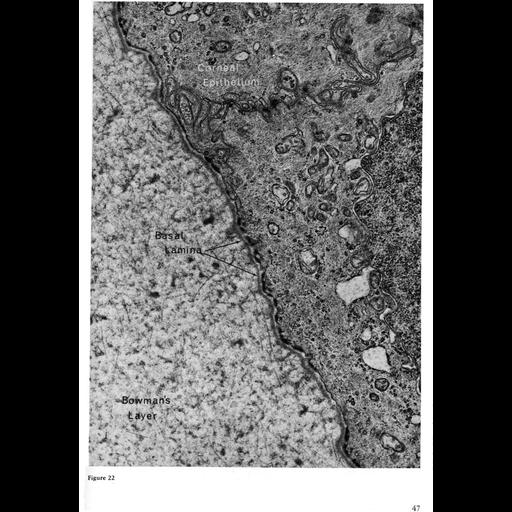  NCBI Organism:Homo sapiens; Cell Types:corneal epithelial cell Cell Components:basal lamina, extracellular region part, plasma membrane; Biological process:cell-substrate adhesion, extracellular structure organization;