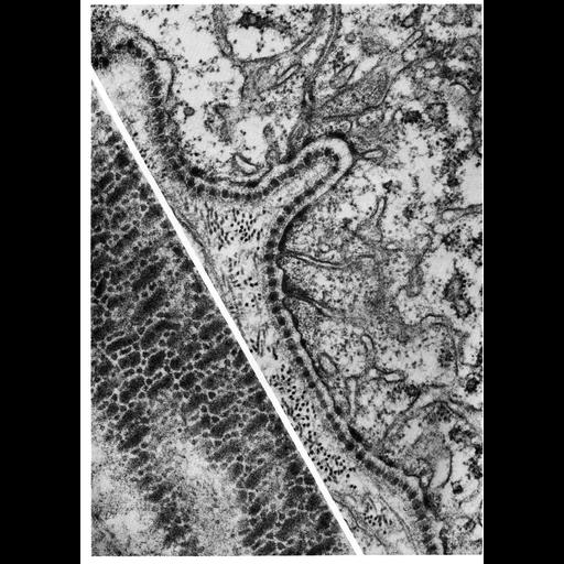  NCBI Organism:Siphonaptera; Cell Types:epithelial cell Cell Components:basal lamina, extracellular region part, plasma membrane; Biological process:extracellular structure organization