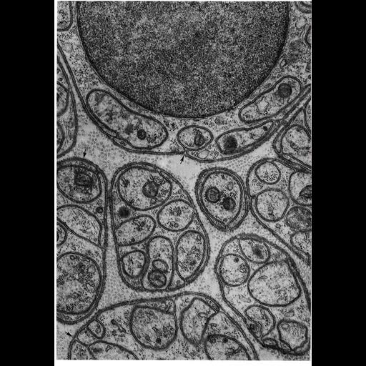  NCBI Organism:Rattus; Cell Types:myelinating Schwann cell, peripheral neuron; Cell Components:basement membrane, extracellular region part, plasma membrane, axon; Biological process:cell-substrate adhesion, extracellular structure organization, basement membrane organization;