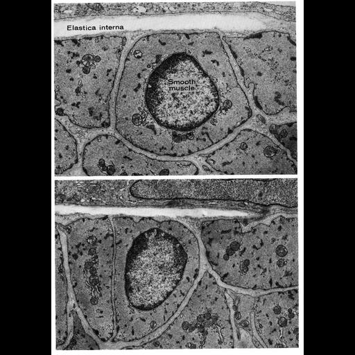  Cell Types:blood vessel endothelial cell Cell Components:basement membrane, extracellular region part, plasma membrane; Biological process:extracellular structure organization